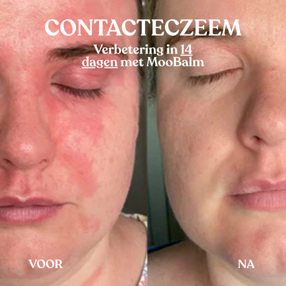 MooBalm Beruhigend