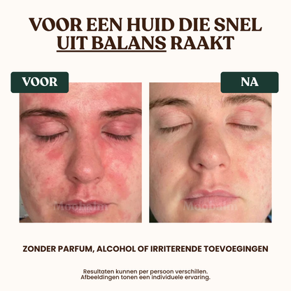 MooBalm Tallow Balm